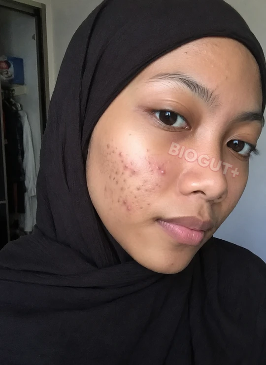 Fatin sebelum BioGut+