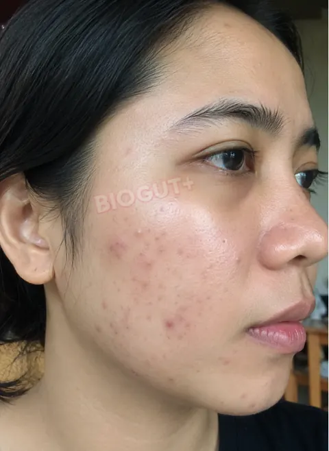 Aisyah sebelum BioGut+