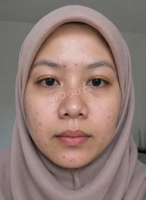 Nadia sebelum BioGut+