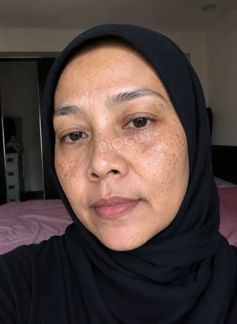 Suria sebelum BioGut+